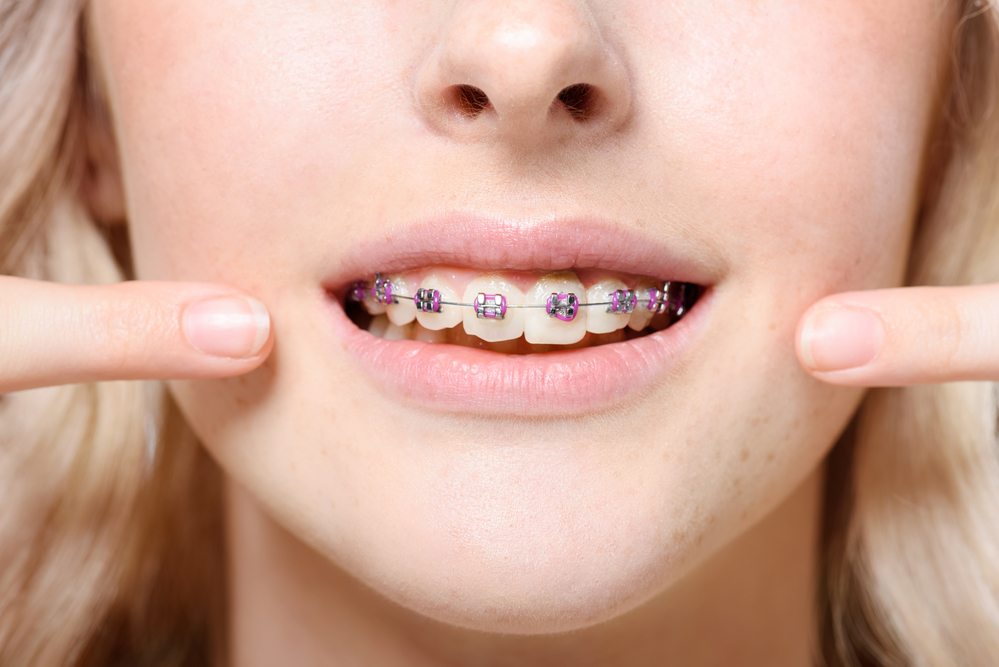 orthodontic